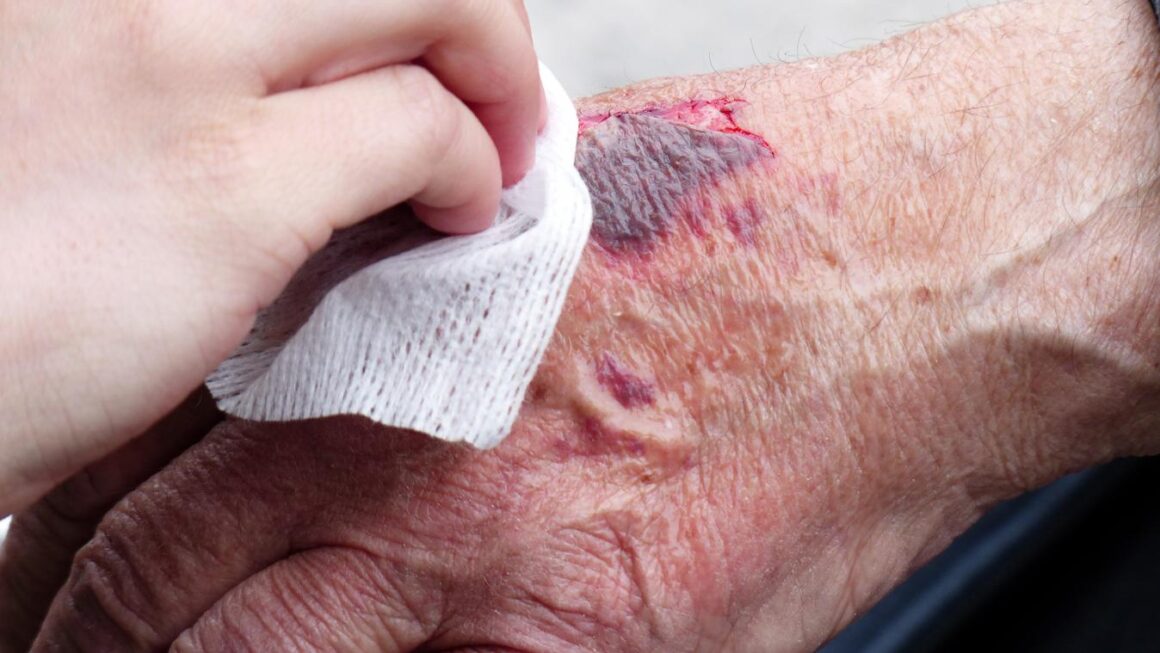 WOUND CARE